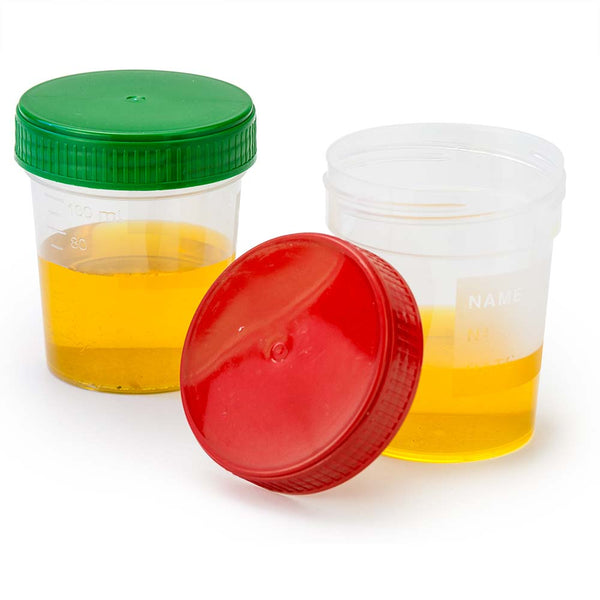 5oz Graduated Urine Collection Container with Snap Cap Non-Sterile Globe  5917