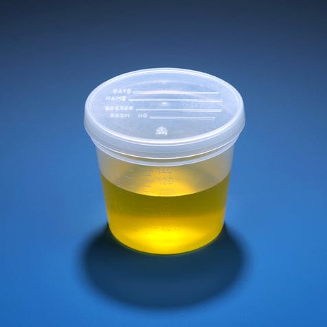 Globe Scientific Specimen Container, 5oz. with Separate Snap Cap, PP ...