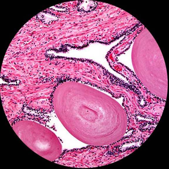 AmScope B120 Binocular Biological Microscope 1000X Magnification and 1W LED Light Source Mechanical Stage