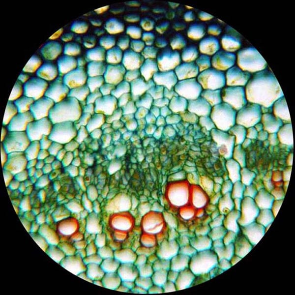 AmScope B120 Binocular Biological Microscope 1000X Magnification and 1W LED Light Source Mechanical Stage