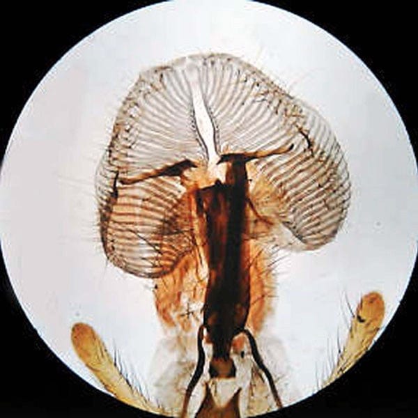 AmScope SE306R-PZ-M Digital Enabled Binocular Stereo Microscope 1.3MP Camera on a Pillar Stand