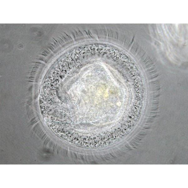AmScope IN300 Series Inverted Phase-Contrast Biological Trinocular Compound Microscope with 30W Halogen and Optional Digital Camera
